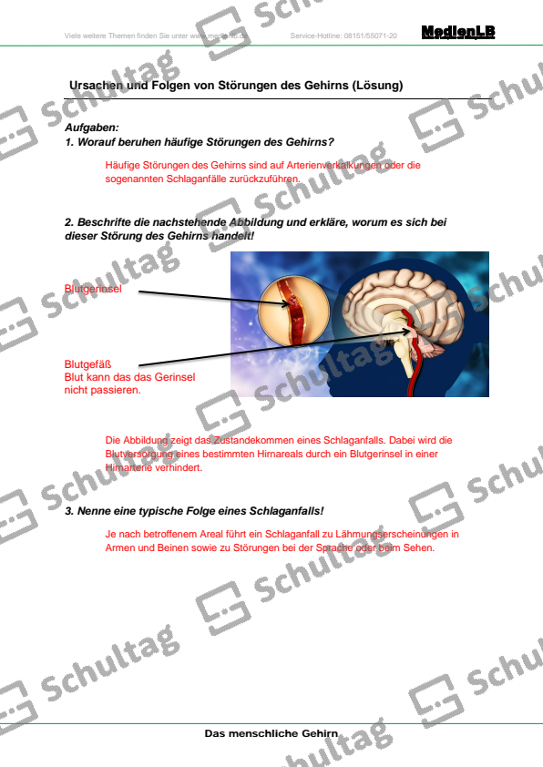 Ursachen und Folgen von Störungen des Gehirns – Schultag